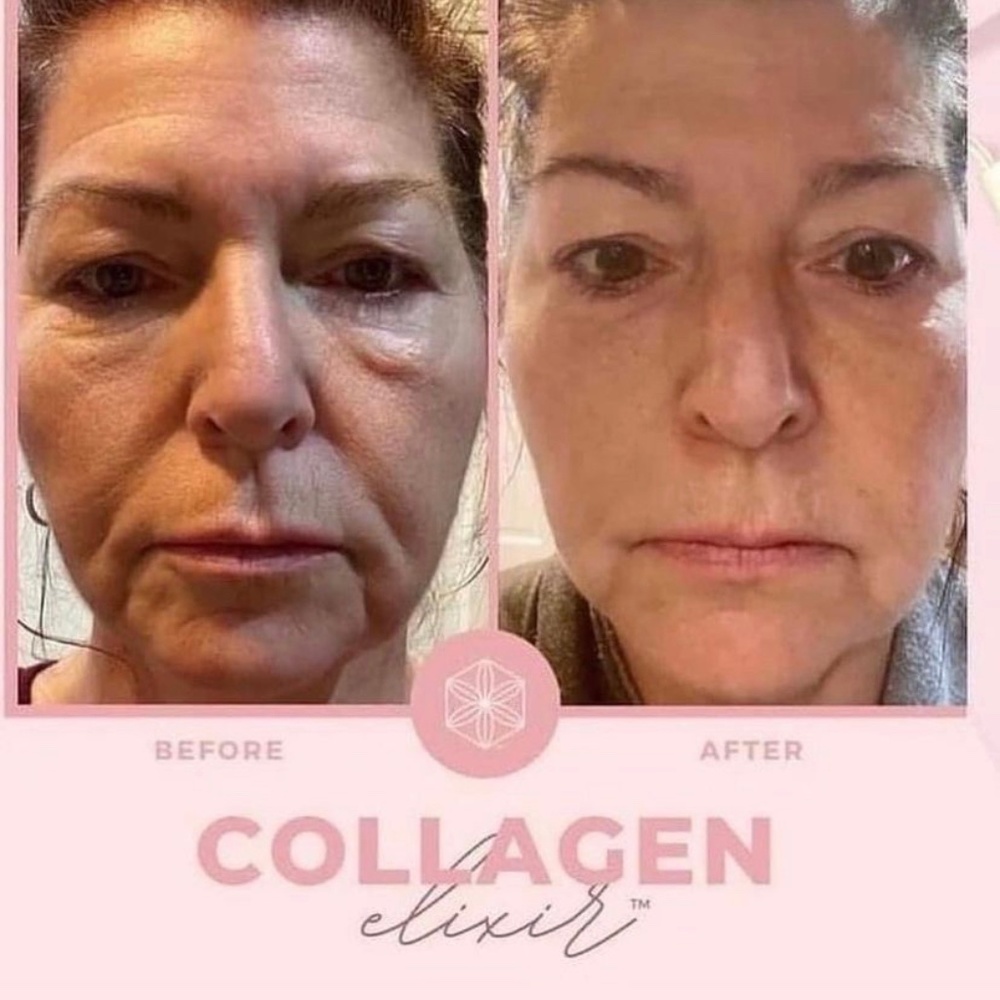 Collagen Elixir- Best Liquid Collagen Guaranteed